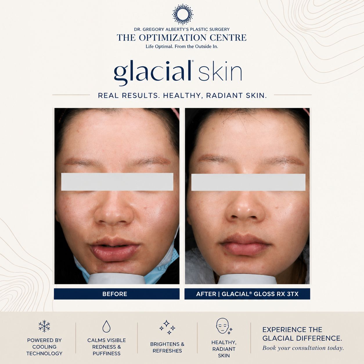 The Coolest Way to Calm, Brighten & Recover: Meet Glacial® Skin