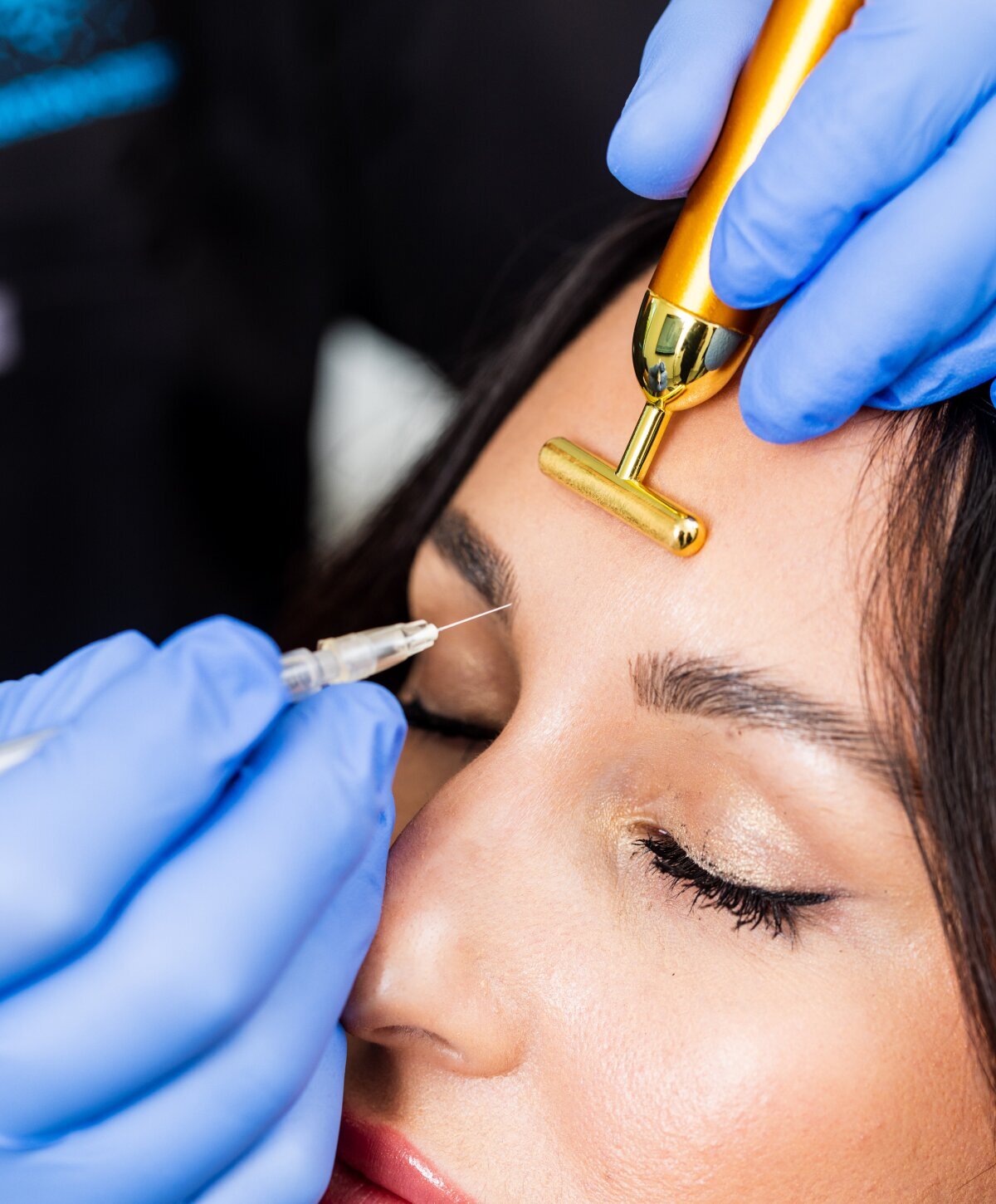 Boca Raton Endoscopic Brow Lift model being treated